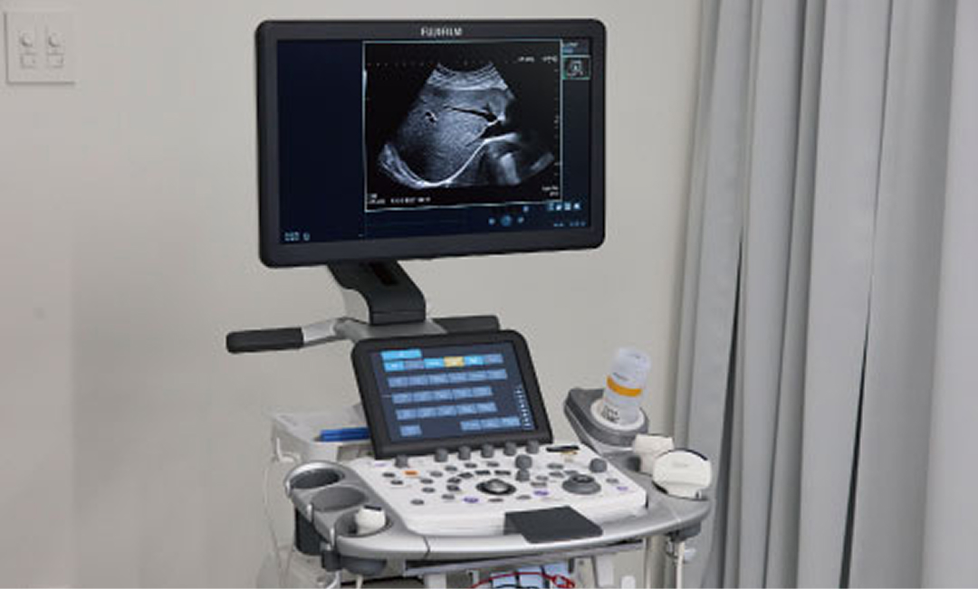 超音波診断装置