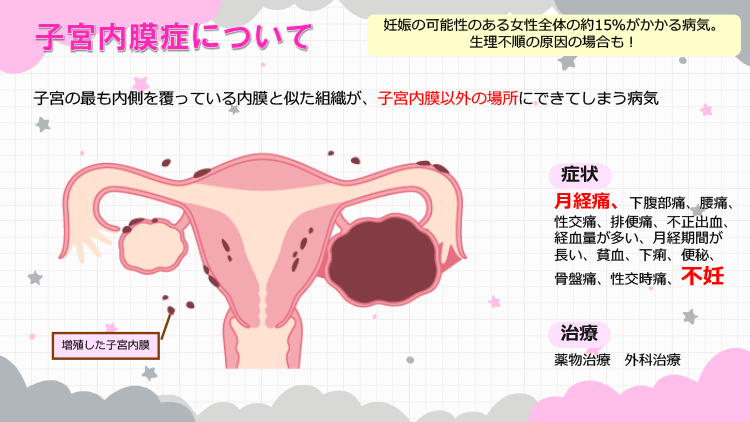 子宮内膜症について