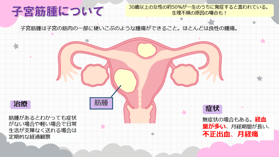 子宮筋腫について