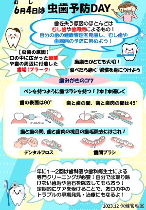 虫歯予防について